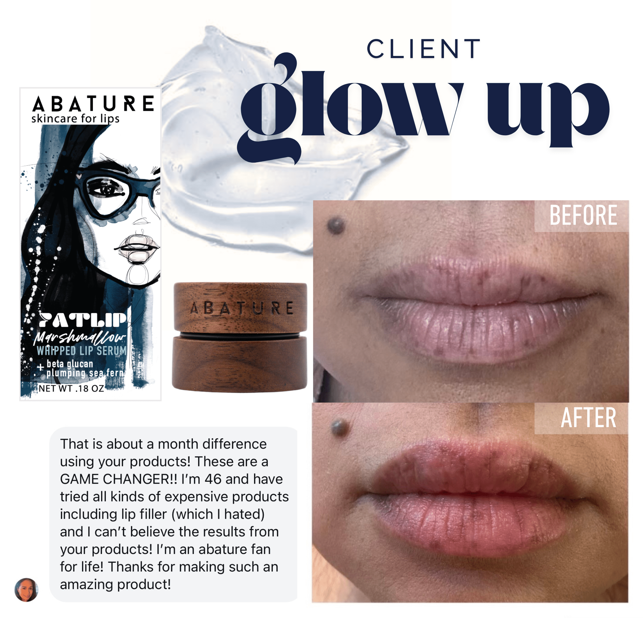 FATLIP Plumping Lip Serum - Abature